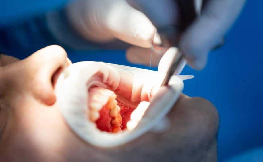 реставрація зуба хмельницький