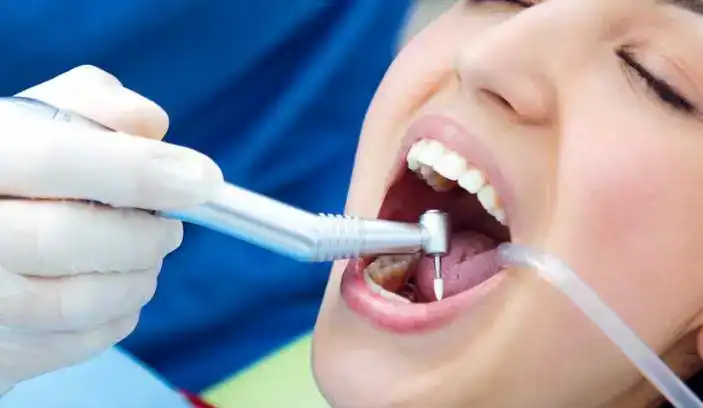 Процес пломбування кореневих каналів під мікроскопом у стоматології VA Clinic, Хмельницький