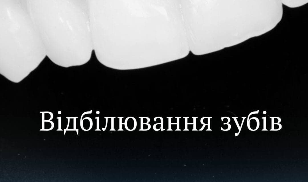 Професійне відбілювання зубів у Va Clinic, Хмельницький біла усмішка за один візит